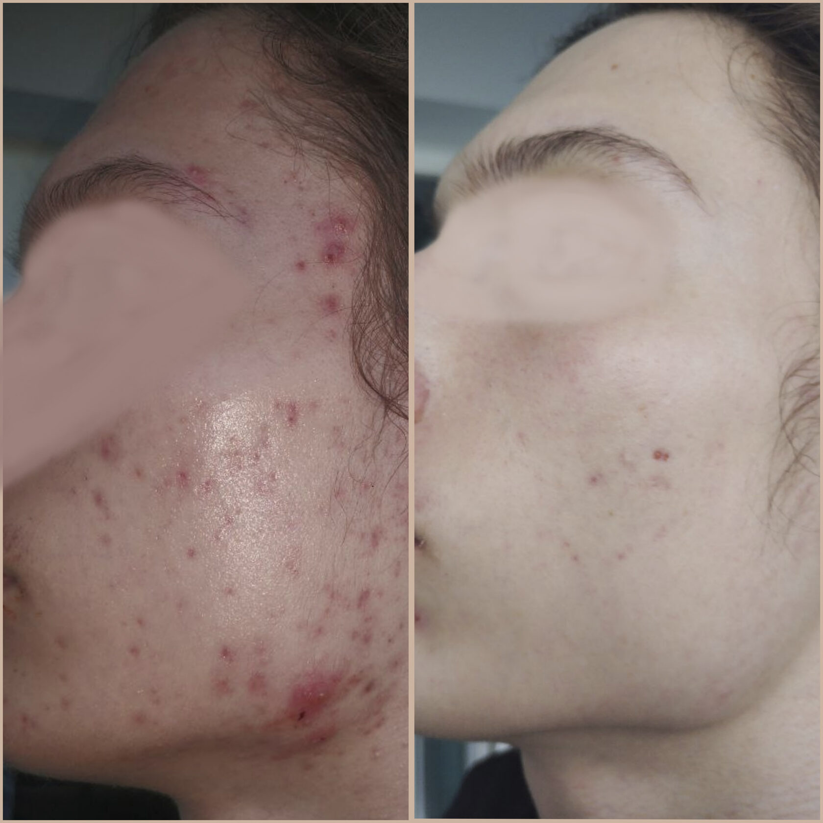 Результат 1