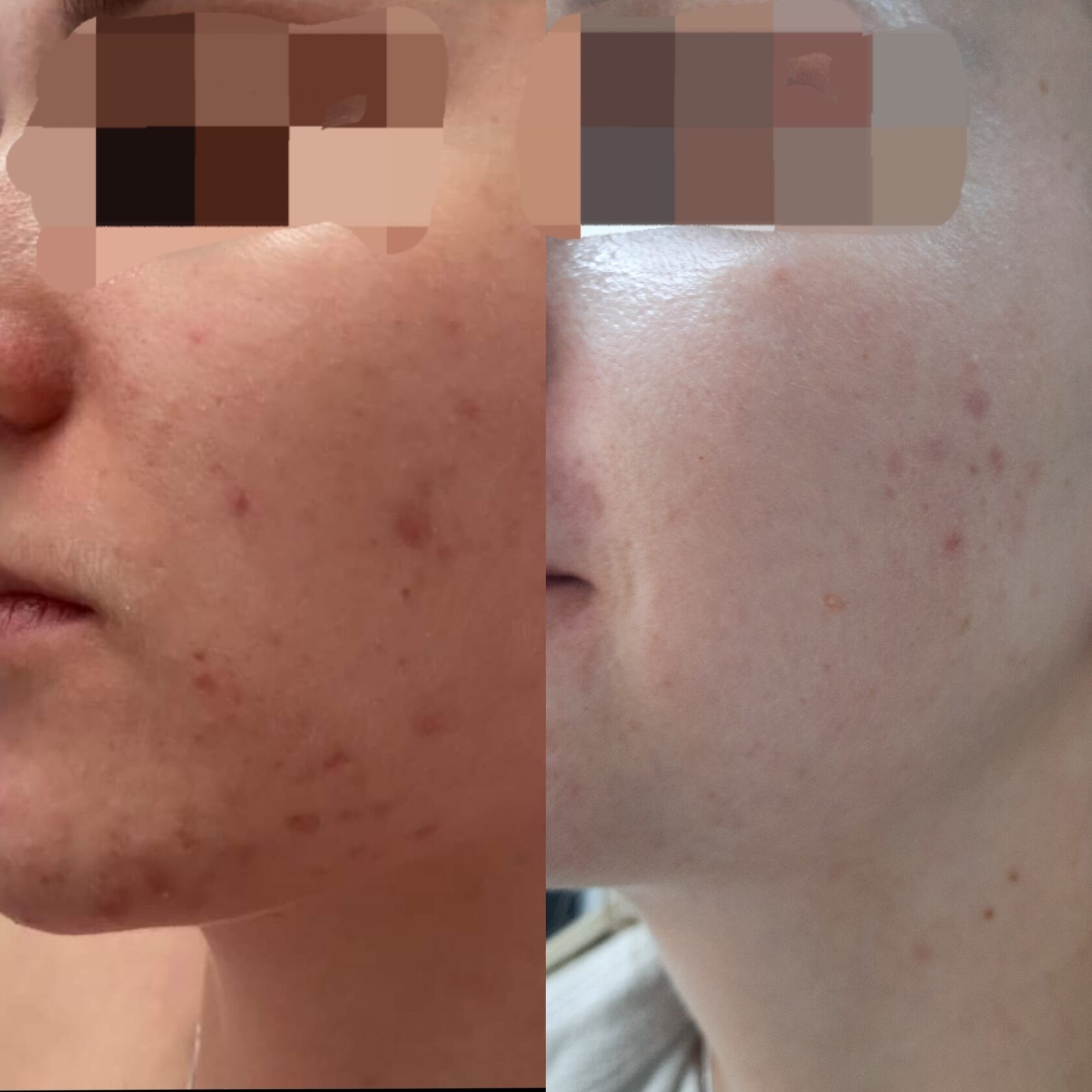 Результат 2