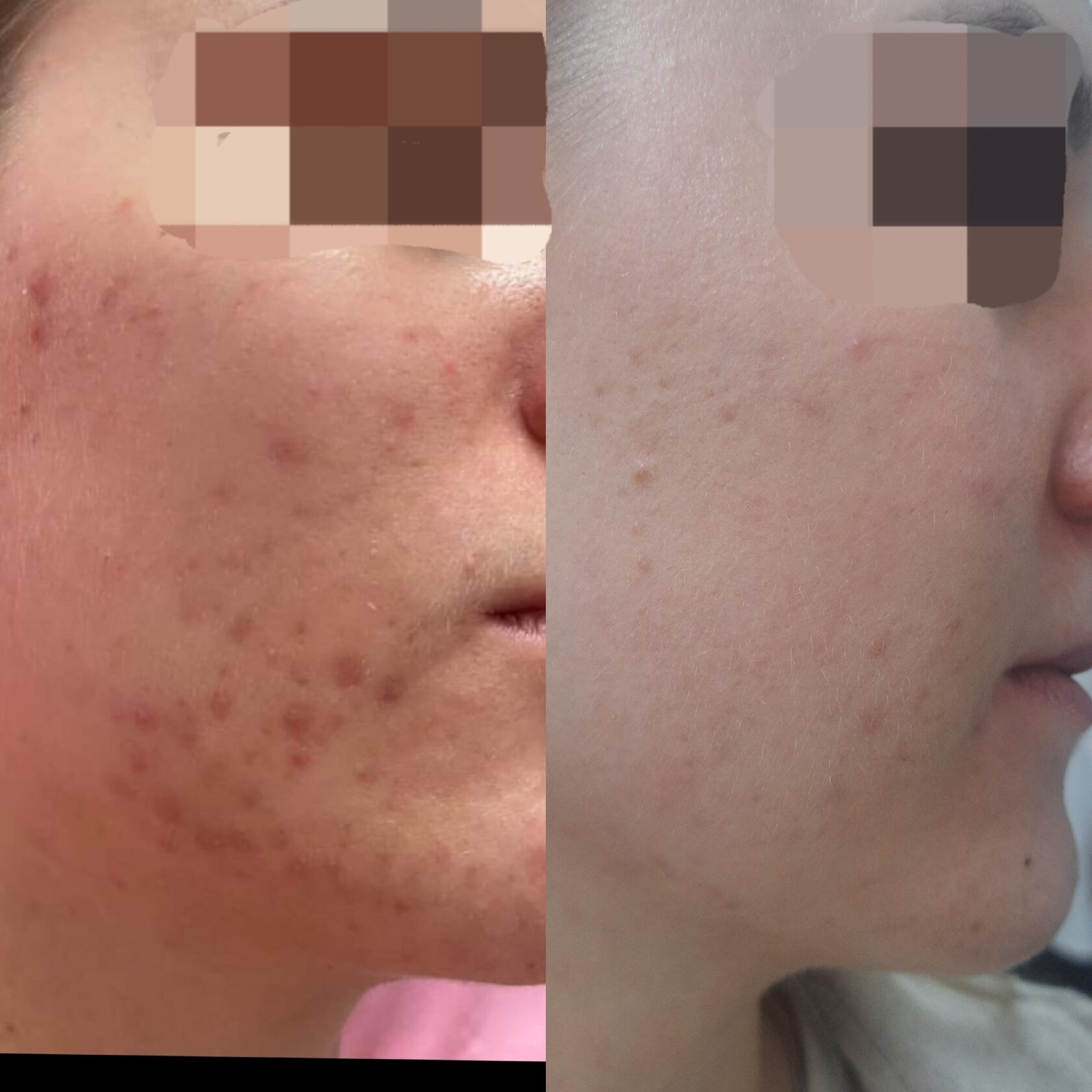 Результат 3