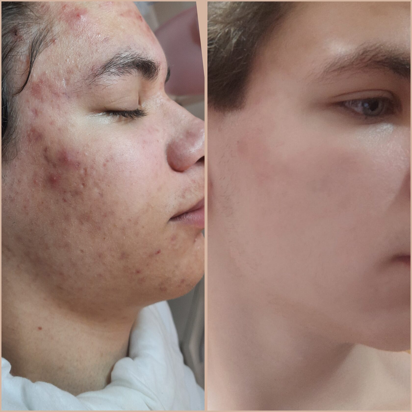 Результат 4