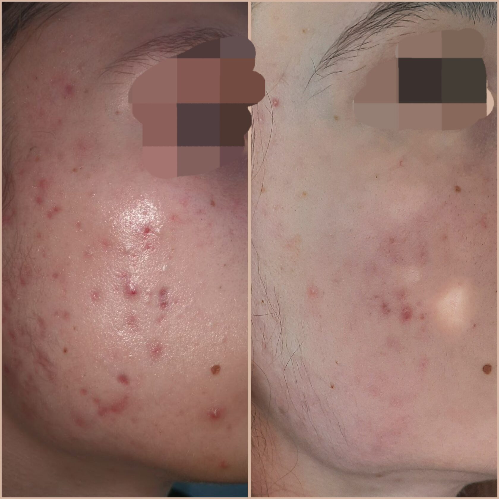 Результат 5