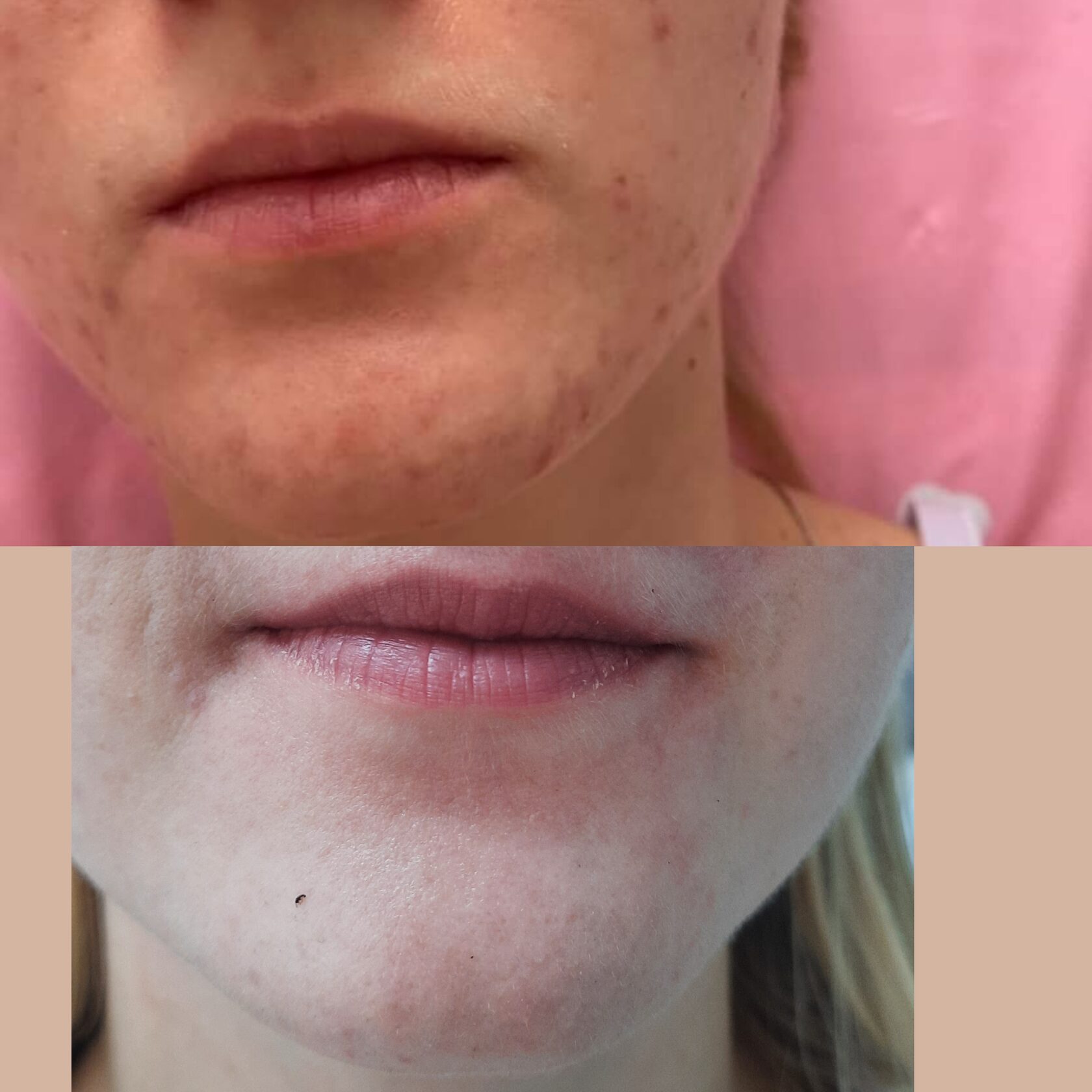 Результат 7