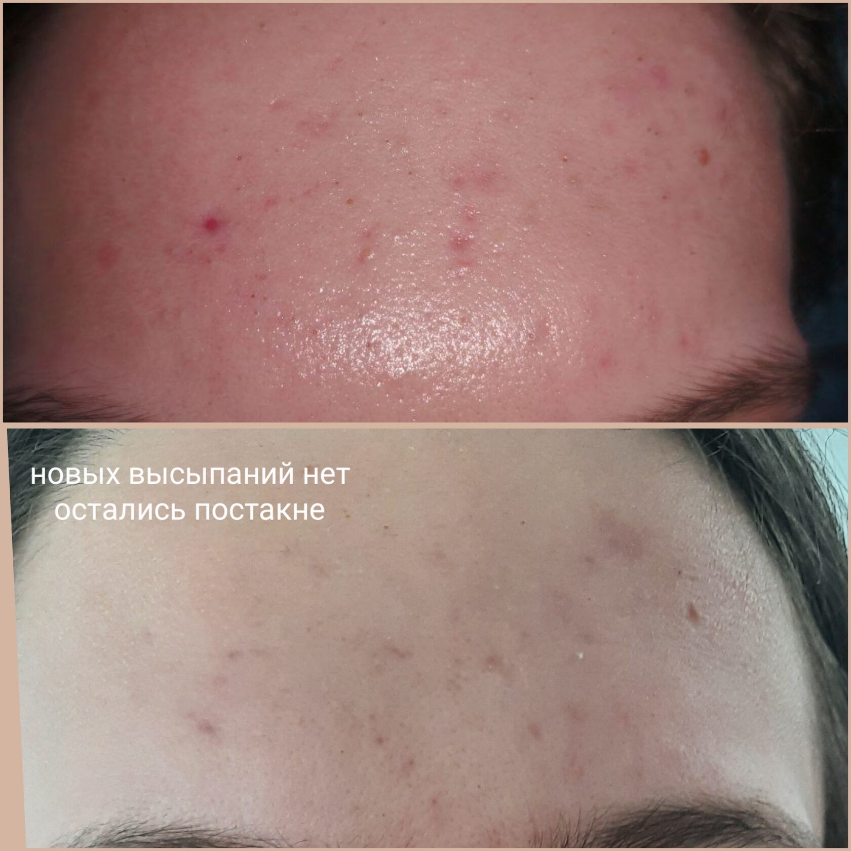 Результат 8