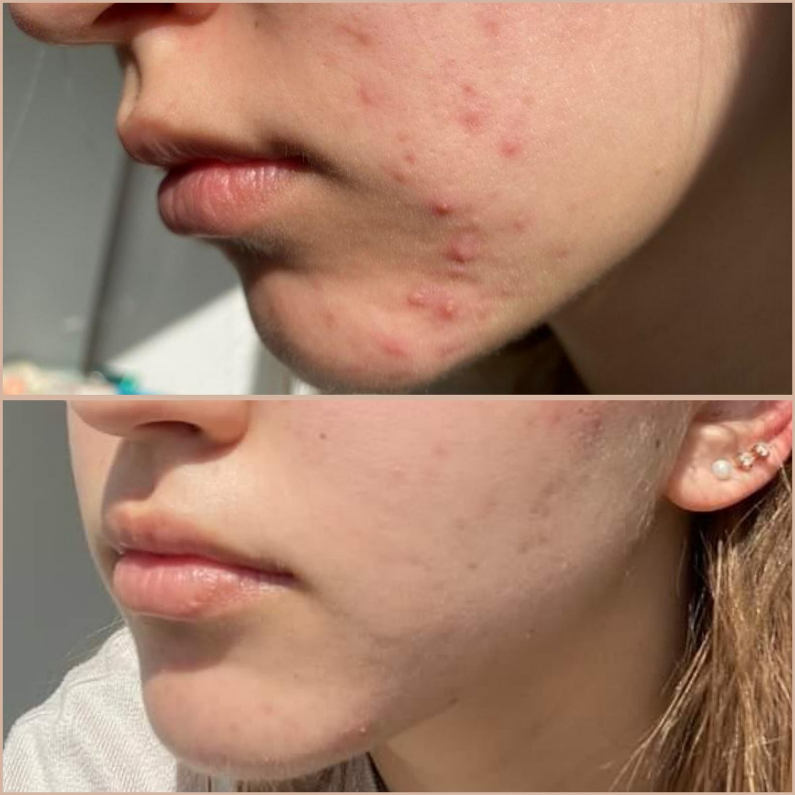 Результат 12