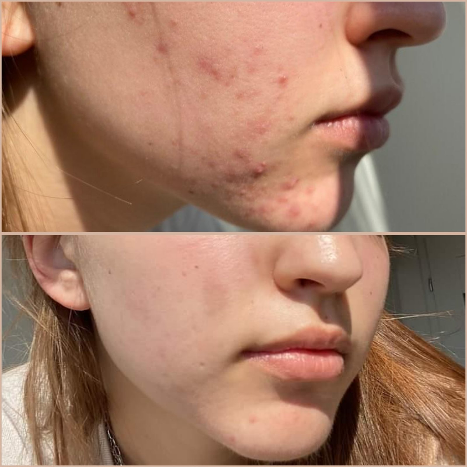 результат 11